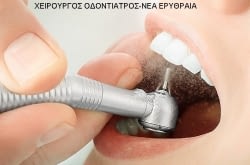 18€ καθαρισμός δοντιών που περιλαμβάνει αφαίρεση πέτρας & πλάκας με χρήση υπερήχων, στίλβωση και σοδοβολή (όπου απαιτείται) από σύγχρονο Οδοντιατρείο στην Νέα Ερυθραία. Ο καθαρισμός των δοντιών μας είναι μια ανώδυνη & απλή διαδικασία και αποτελεί μία θεραπευτική και προληπτική διαδικασία για υγιή και όμορφα δόντια.