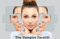 89€ συνεδρία PRP-Αυτόλογη Μεσοθεραπεία (Vampire Face Lift) στο Athens Medical SPA σε κομβικό σημείο στο κέντρο της Αθήνας, εύκολα προσβάσιμο με το μετρό. Αποκτήστε λάμψη με επιστημονική επίβλεψη για φυσικά αποτελέσματα!! Είναι η τελευταία εξέλιξη στον τομέα της αντιγήρανσης και γίνεται με συστατικά που προέρχονται από τον ίδιο μας τον οργανισμό!!